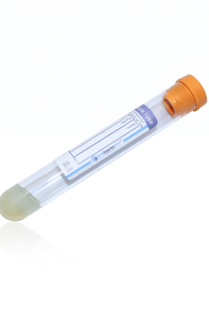 Vacuum Blood Collection Tube – Serum Separator Tube (SST), 8.5 mL, Yellow Top